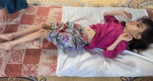 أطباء بلا حدود: ربع أطفال غزة يعانون سوء التغذية